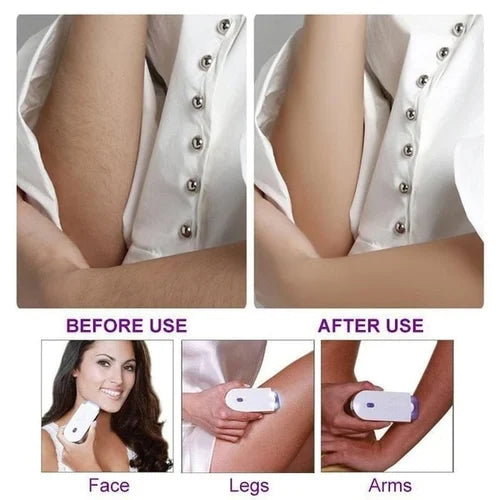 🌟 Imported™ Yes Finishing Touch Face Body Instant Pain Free Hair Removal